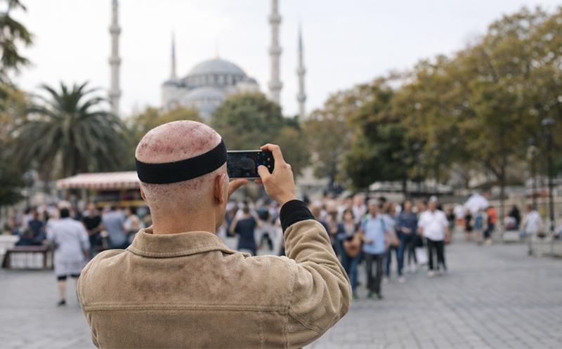 Man visiting Istanbul during a trip for a hair transplant in Turkey